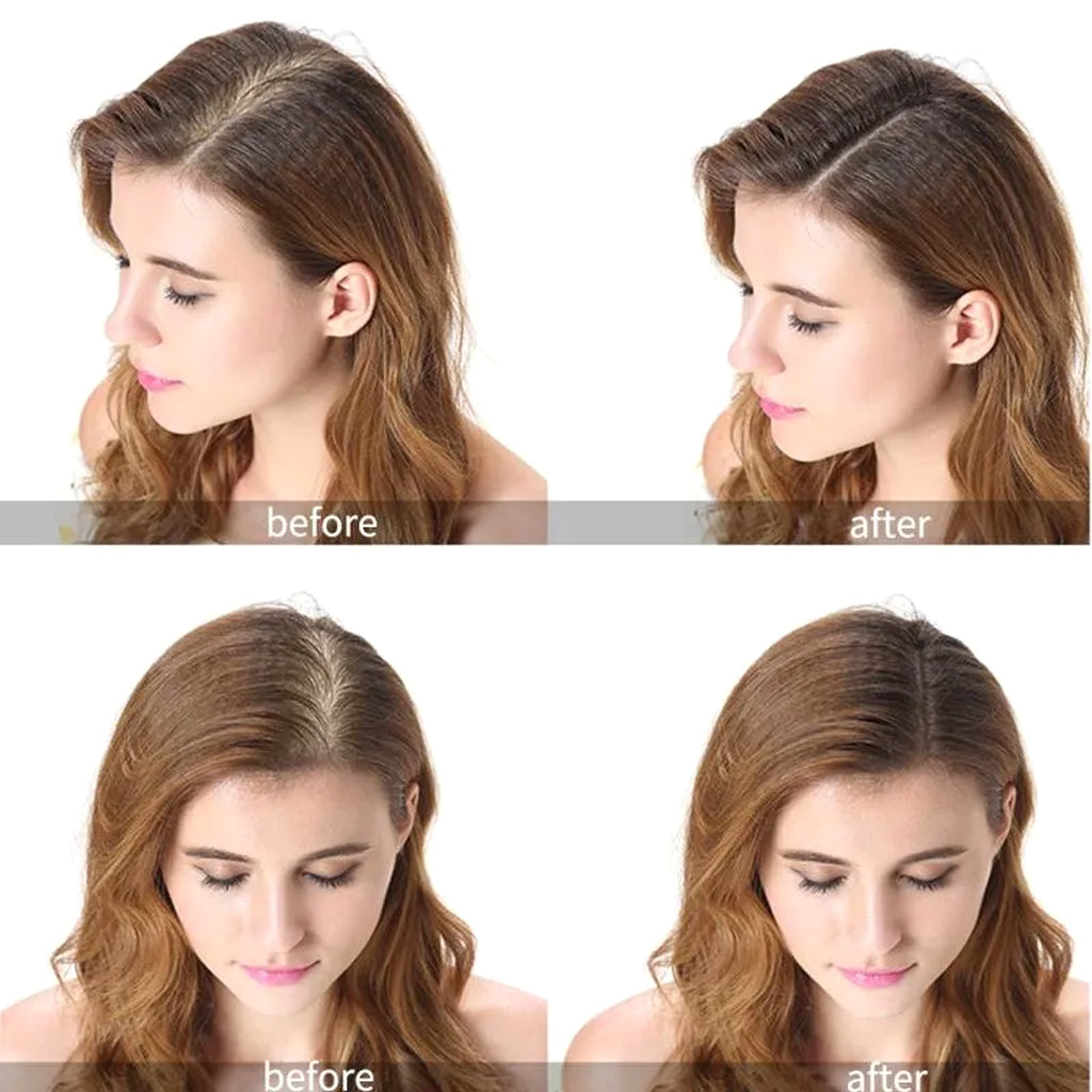 GingerGrow™ Professional Hair Care Kit - enhanced image 1