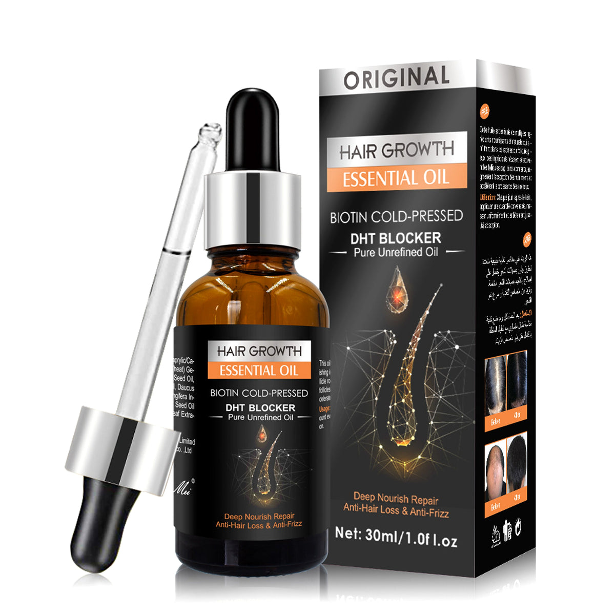 GINGERLAB™ Dandruff Defense & Growth Set - enhanced image 1