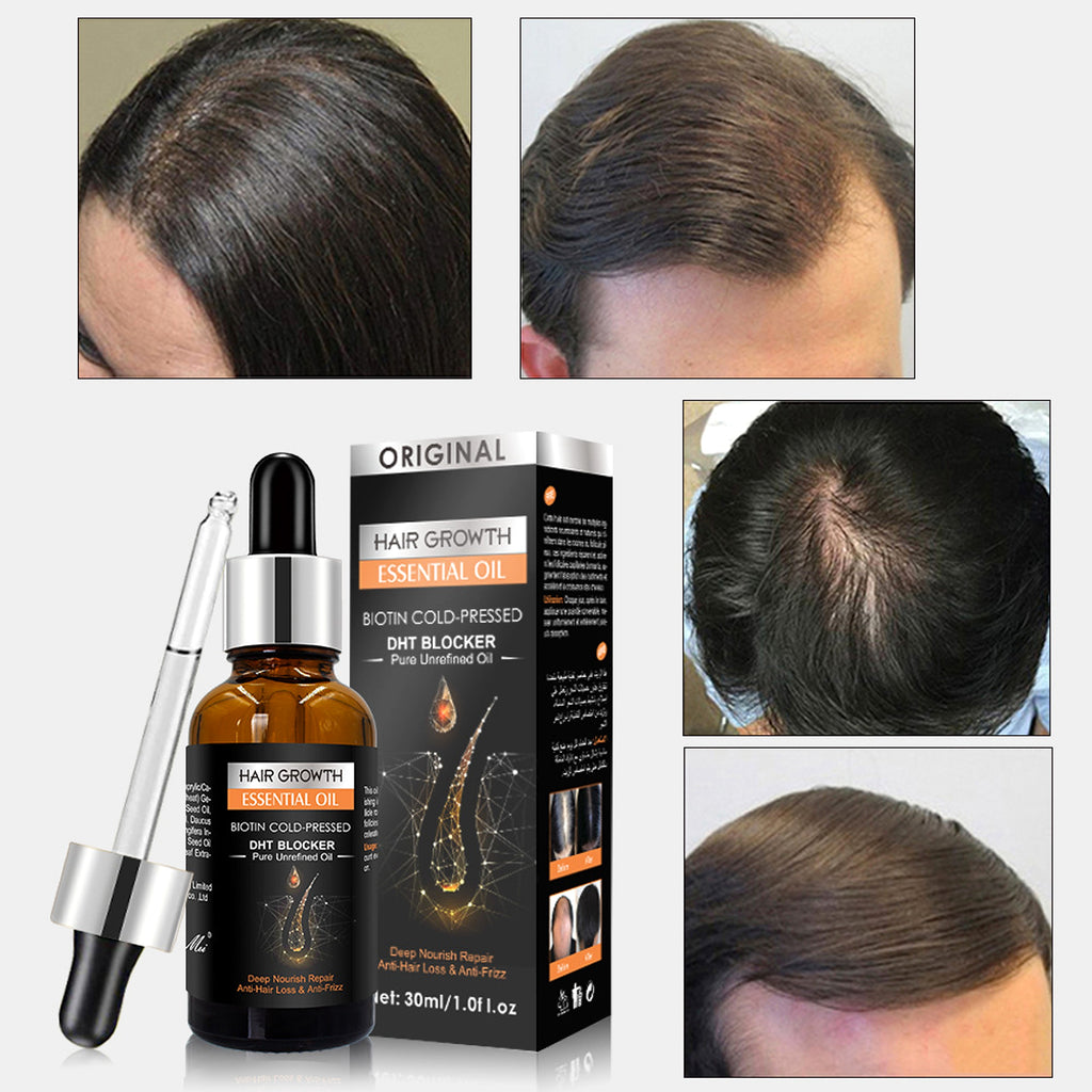 GINGERLAB™ Dandruff Defense & Growth Set - enhanced image 2