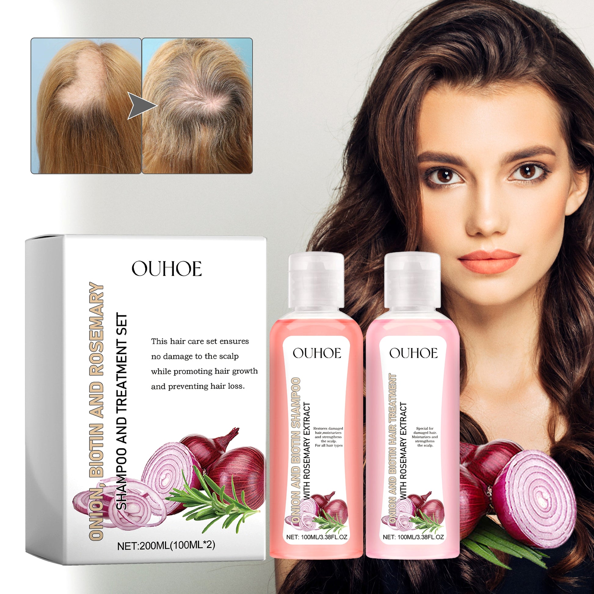 RootRenew™ Biotin & Botanical Boost Set - enhanced image 2