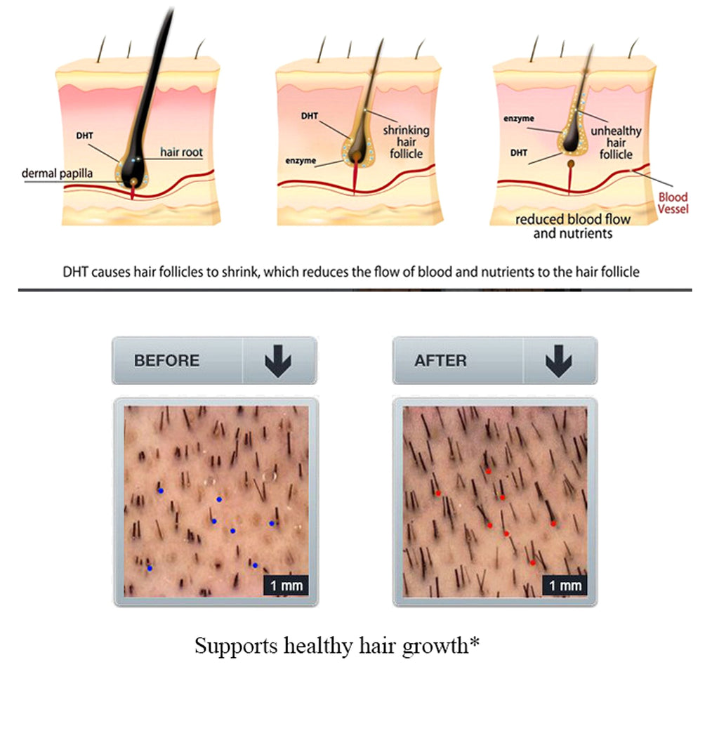 GingerGrow™ Professional Hair Care Kit - enhanced image 3
