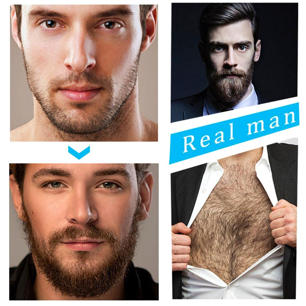 MF-G&NG™ – Beard Growth Kit with Roller & Activating Serum - enhanced image 3