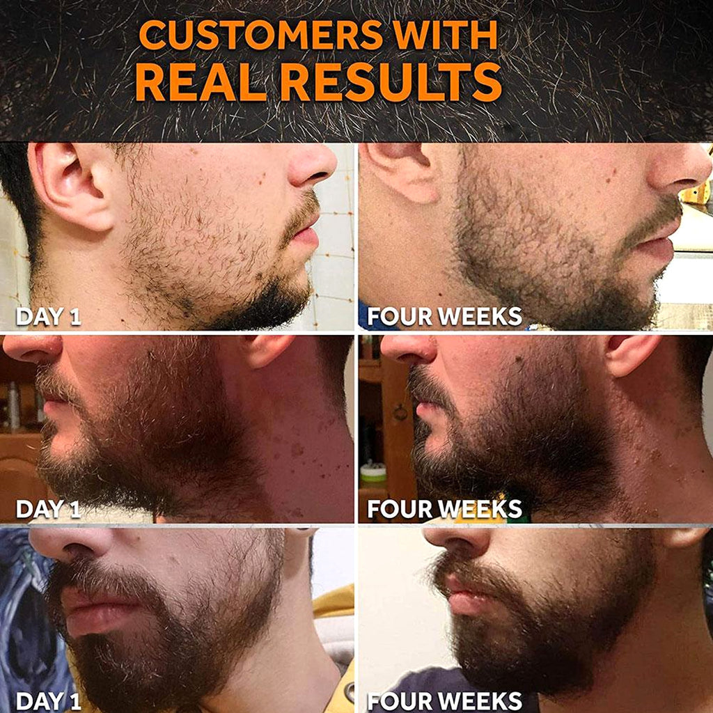 MF-G&NG™ – Beard Growth Kit with Roller & Activating Serum - enhanced image 5