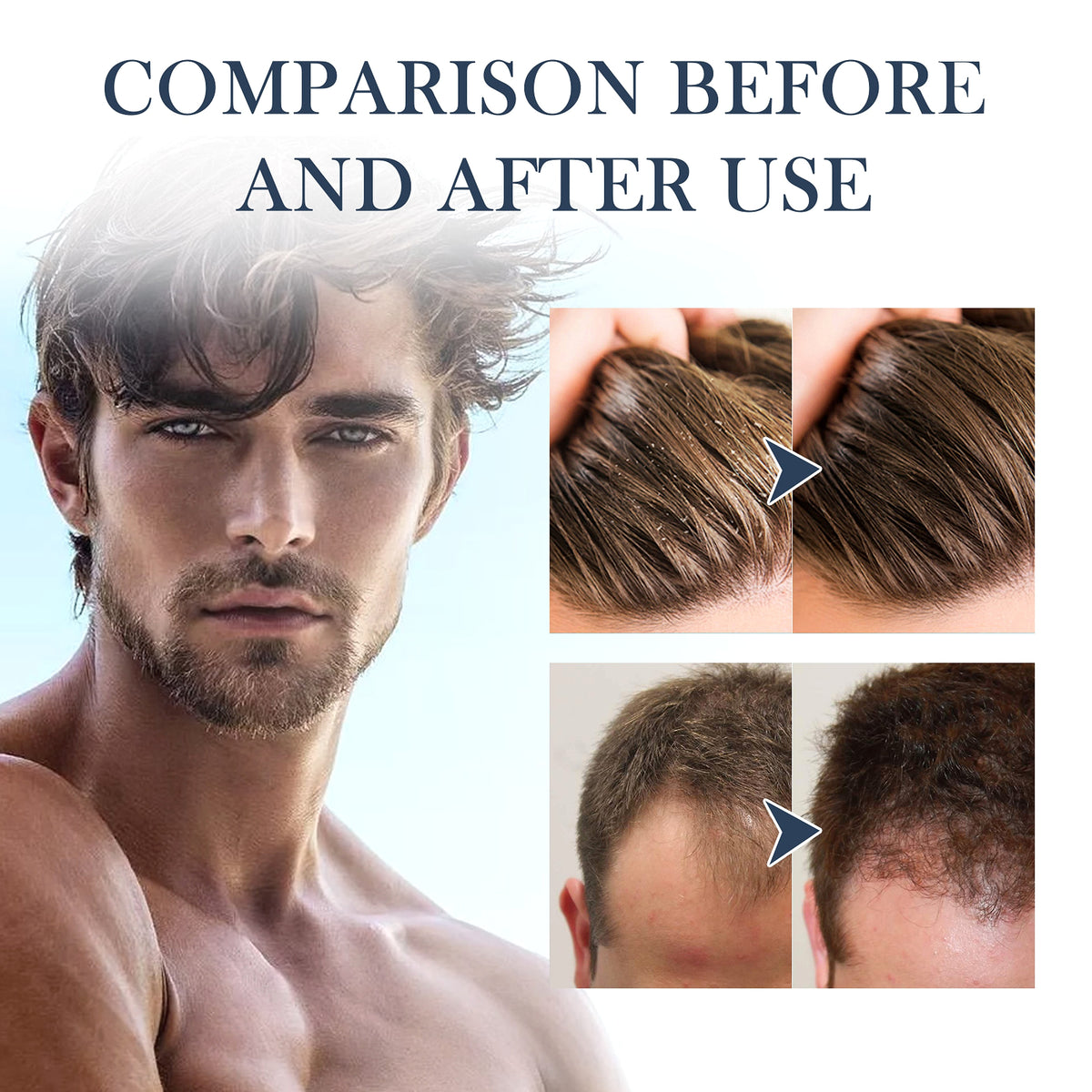 East Moon™ Hair Strengthening Shampoo – Power & Purity for Men - enhanced image 8